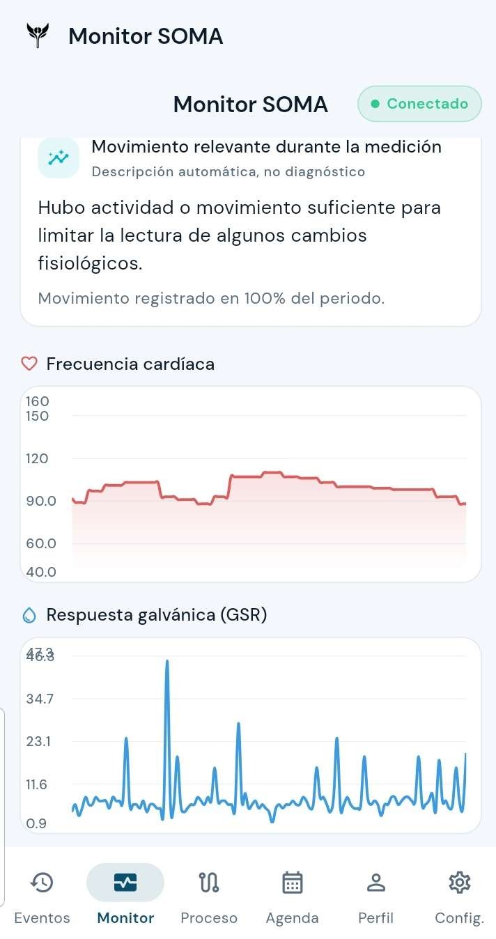 Monitor SOMA en la app móvil